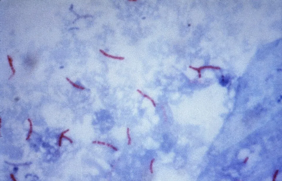 AI Designs 16 New Viruses From Scratch to Fight Drug-Resistant Bacteria