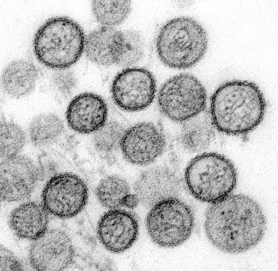 US Ends Hantavirus Response as Questions Mount Over RFK Jr.'s Draconian Quarantine Orders